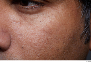 HD Face Skin Kendun Mahlun cheek face skin pores skin…